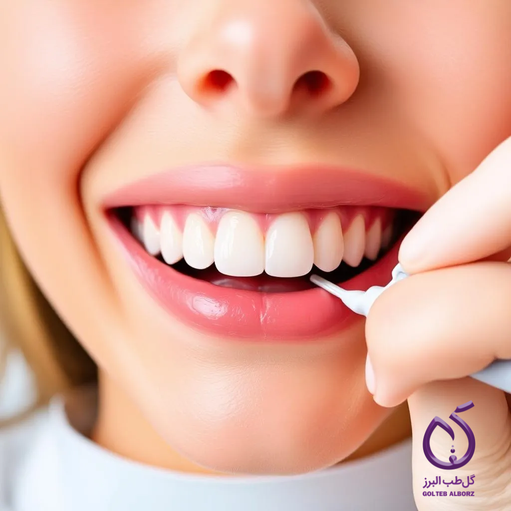 چرا جرم‌گیری دندان‌ها ضروری است؟ بررسی نقش جرم‌گیری در پیشگیری از بیماری‌های لثه